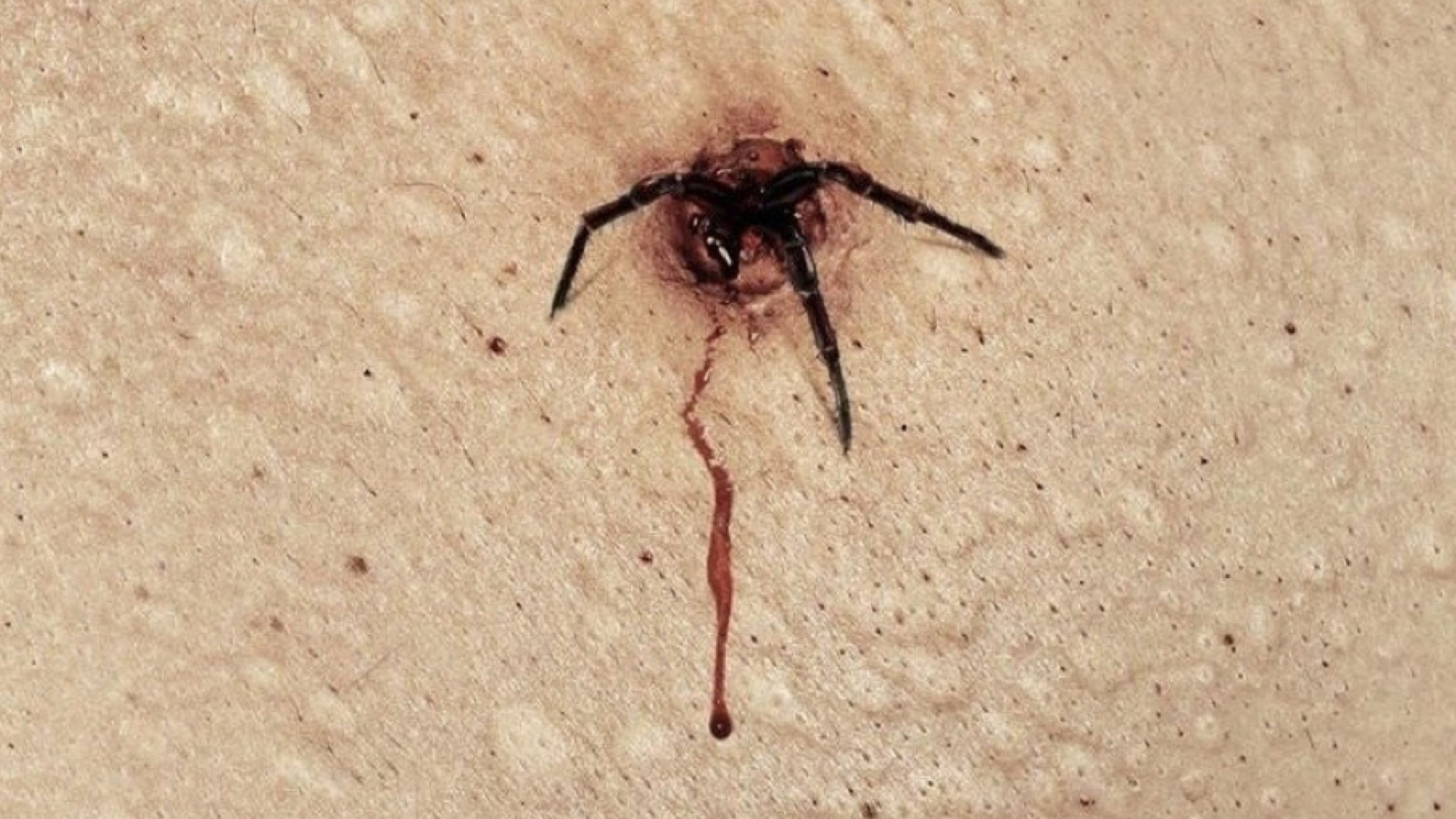 The Plague
