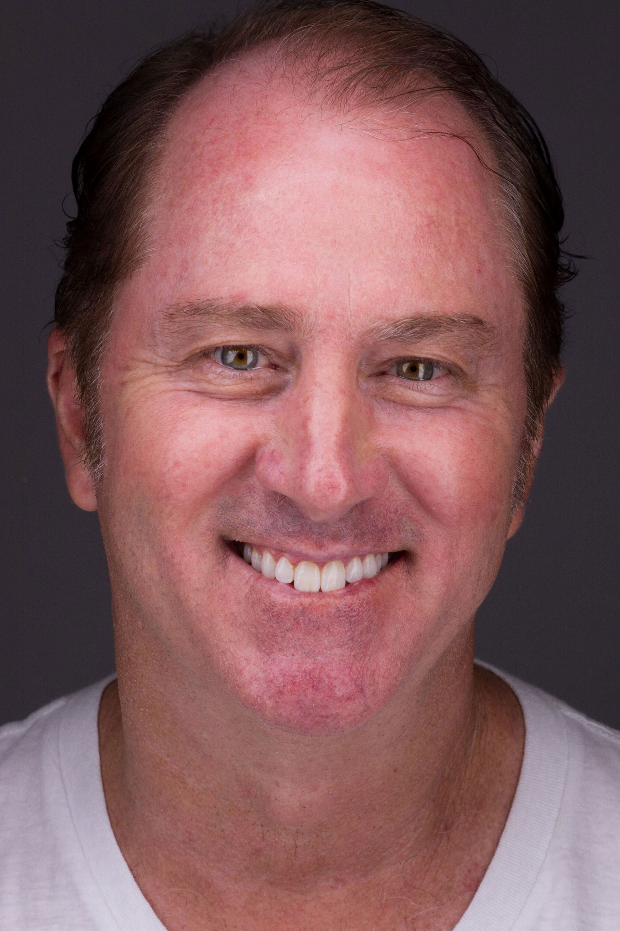 et billede af Doug Walker