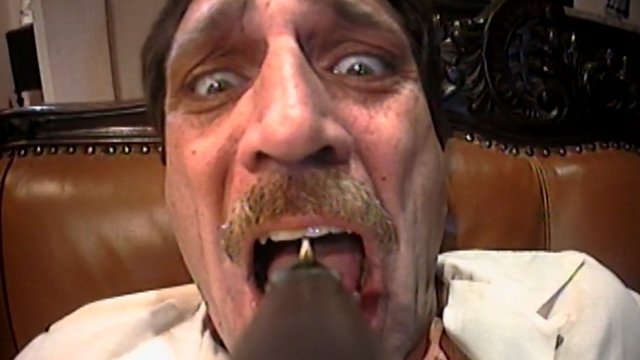 Episode 76