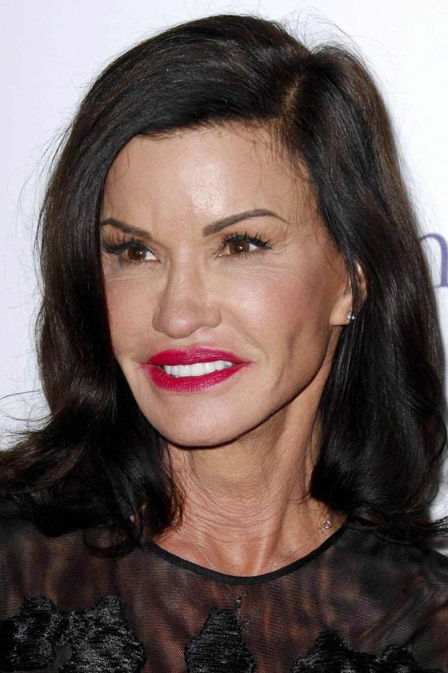 Janice Dickinson