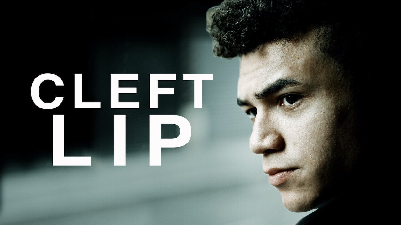 Cleft Lip (2019)