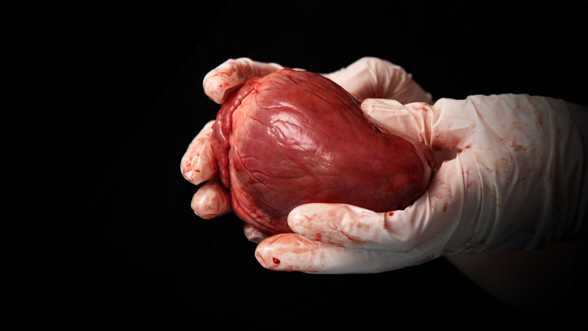 State Organs: Unmasking Transplant Abuse in China