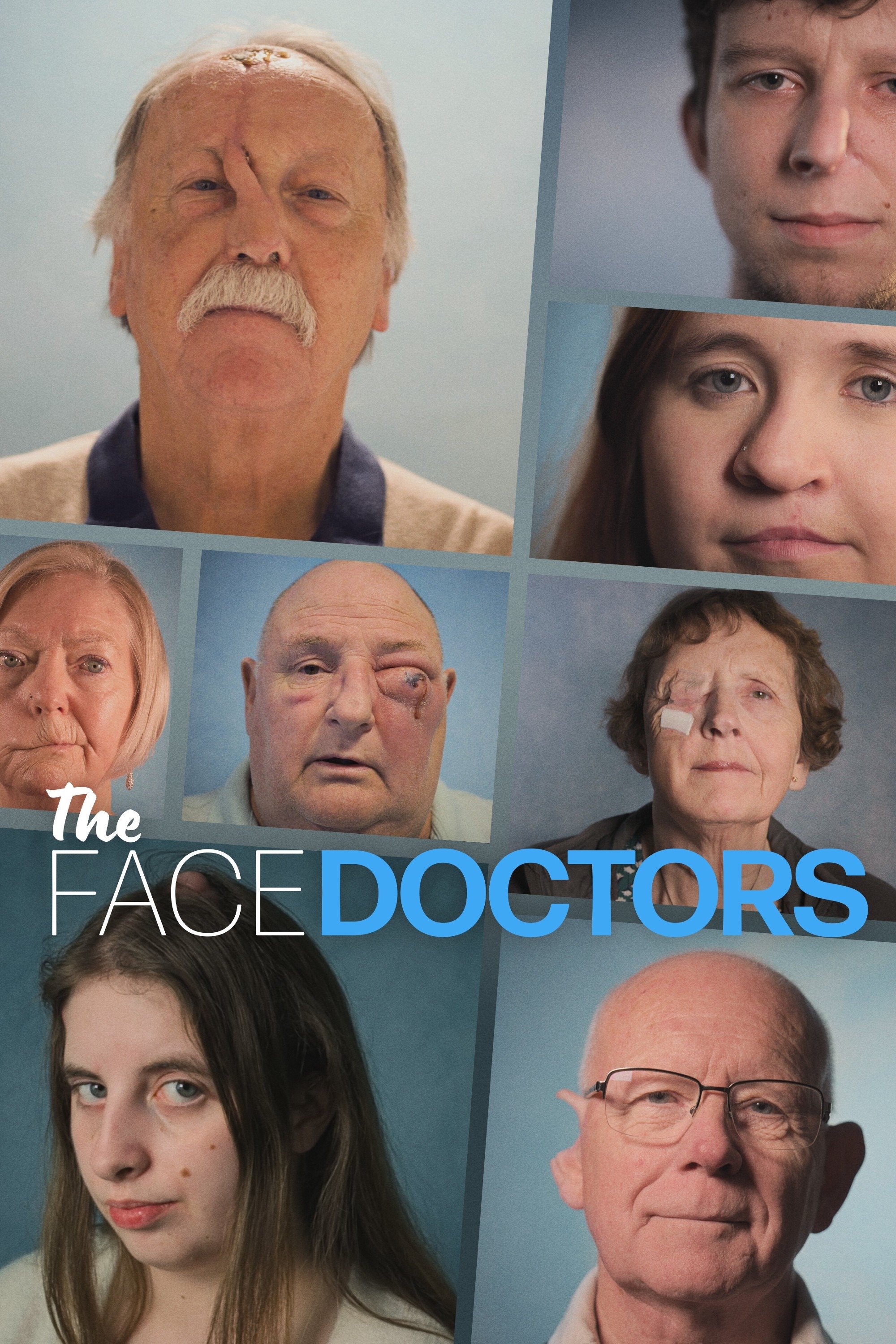 Chirurgie du visage : un nouvel espoir Chirurgie du visage : un nouvel espoir