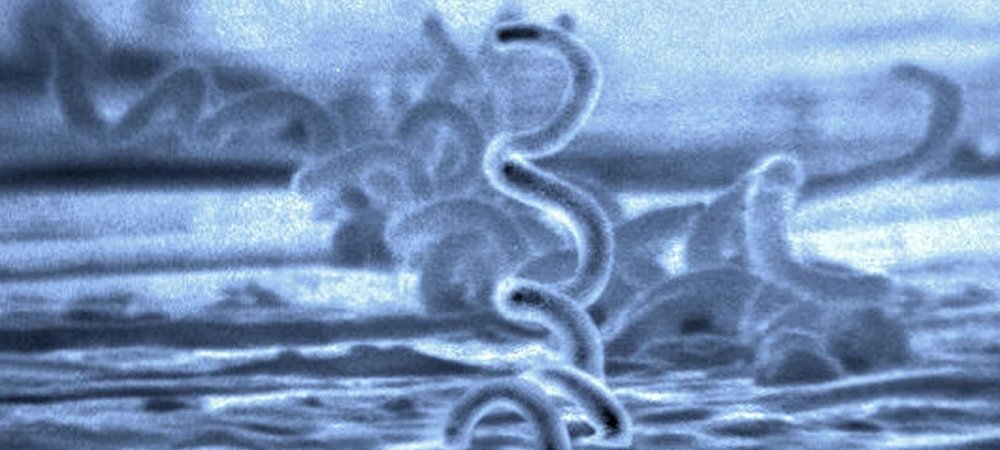 Backdrop of Under Our Skin