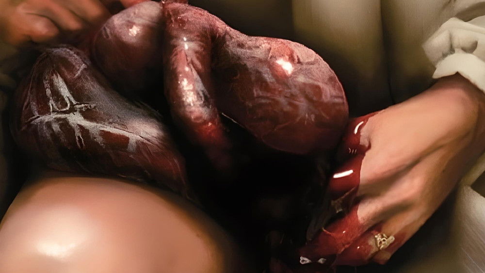 灵婴,The Brood(1979电影)