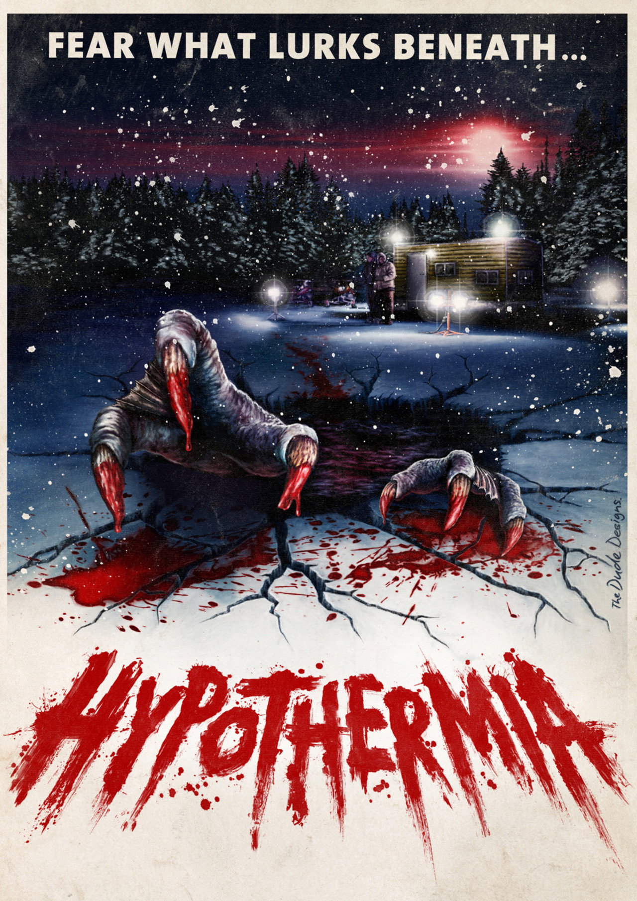 Hypothermia