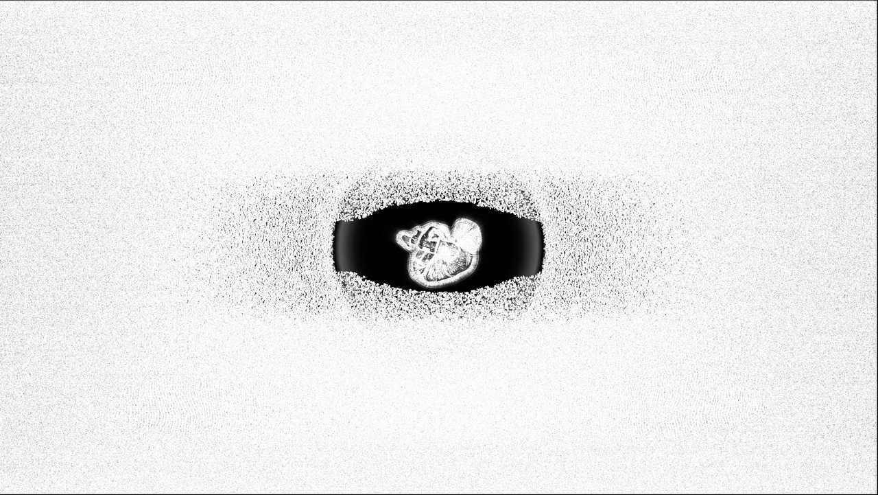 backdrop Severe Severance