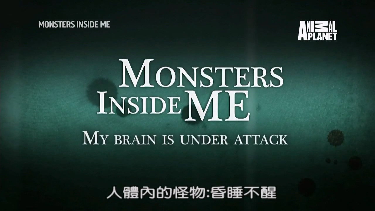 My Brain Is Under Attack