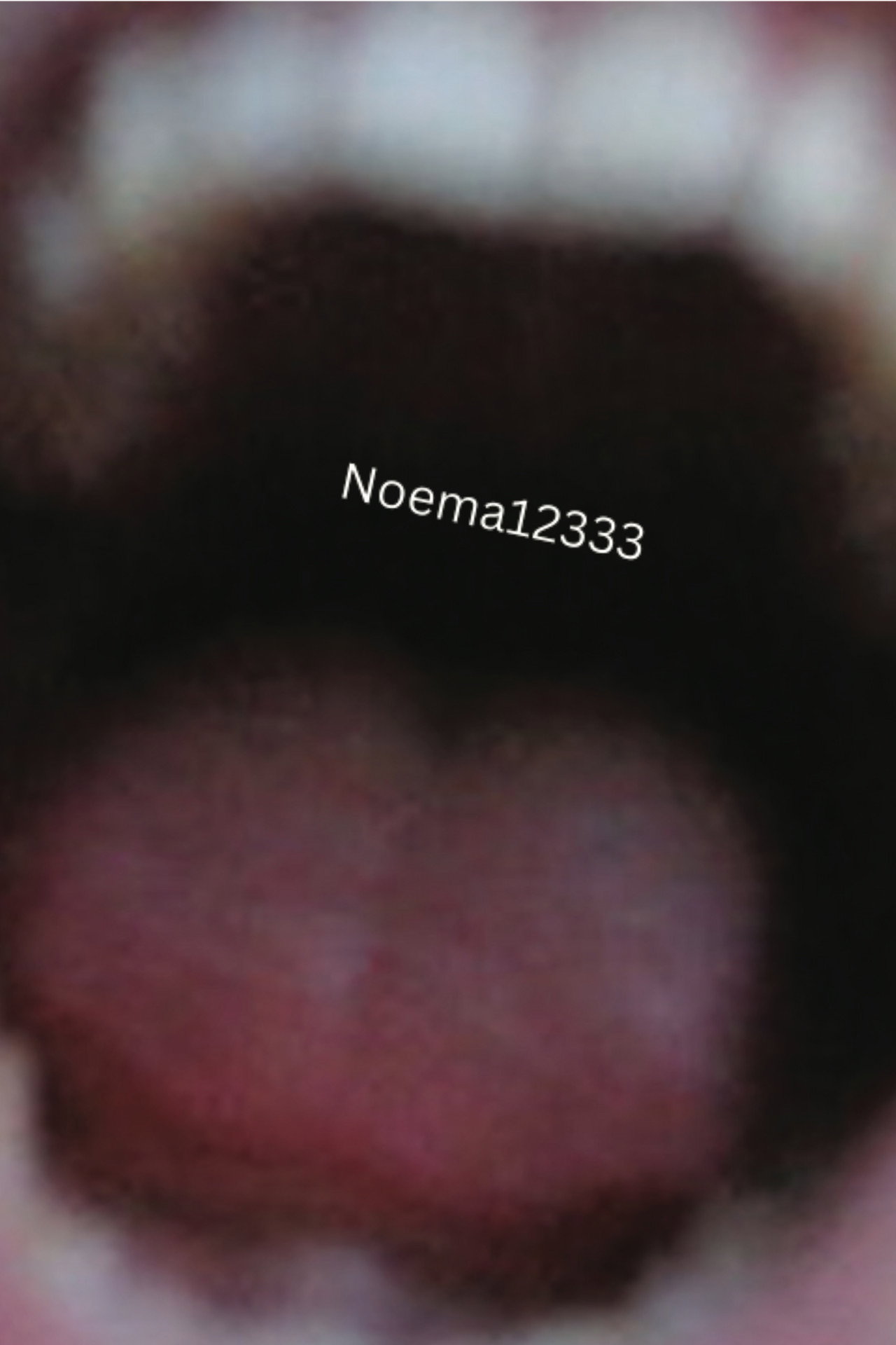 Noema12333