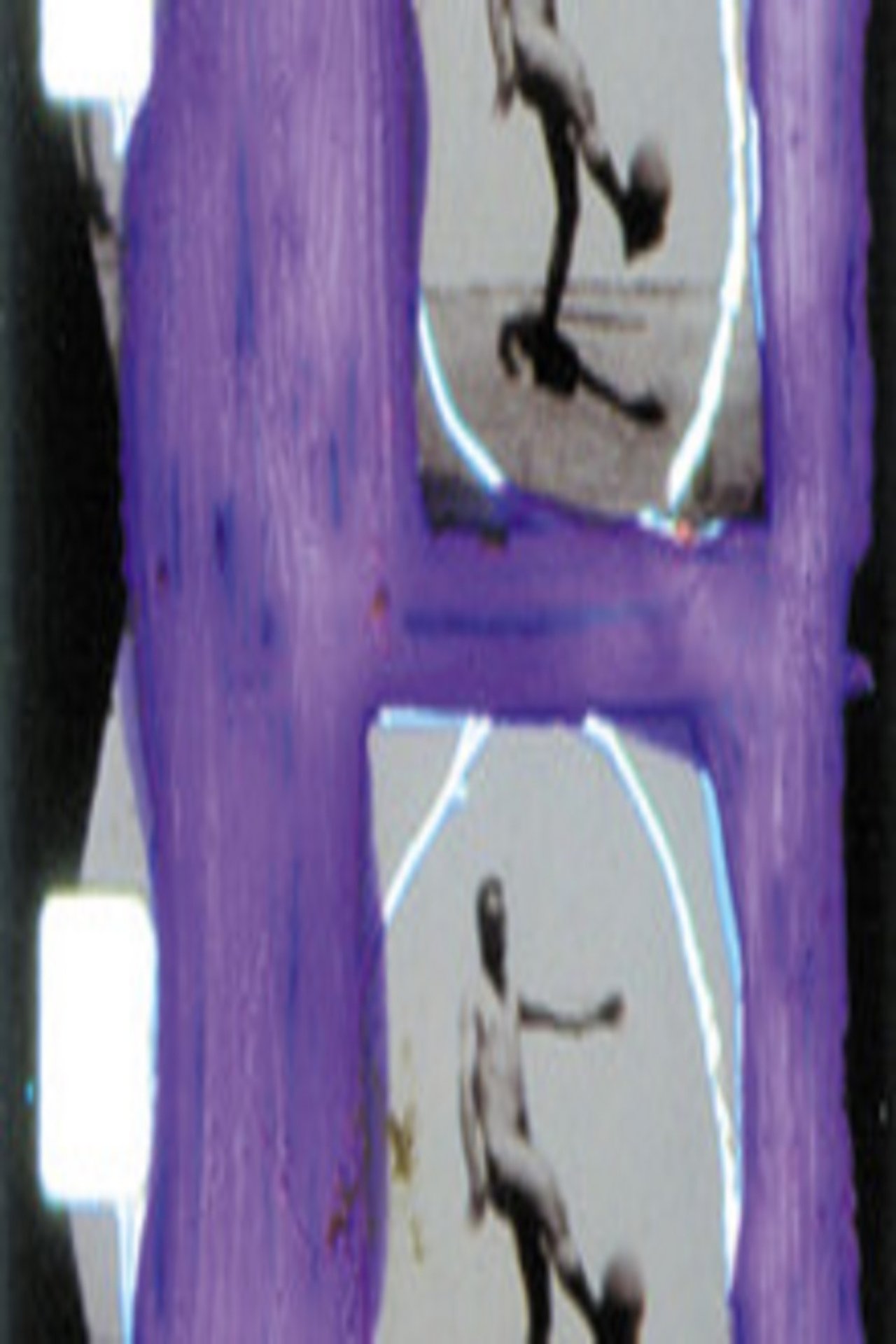 enlarged Poster 0