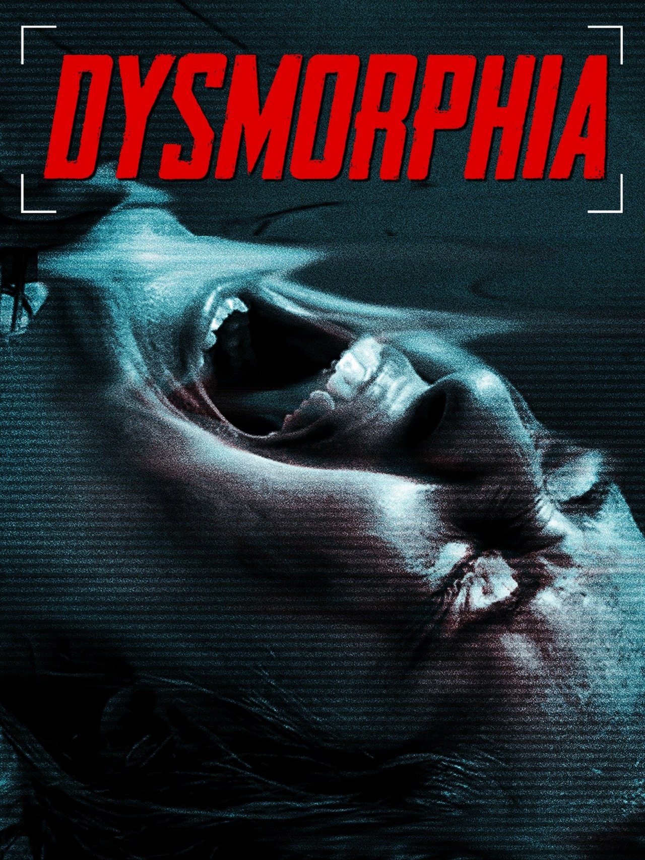 Dysmorphia Dysmorphia
