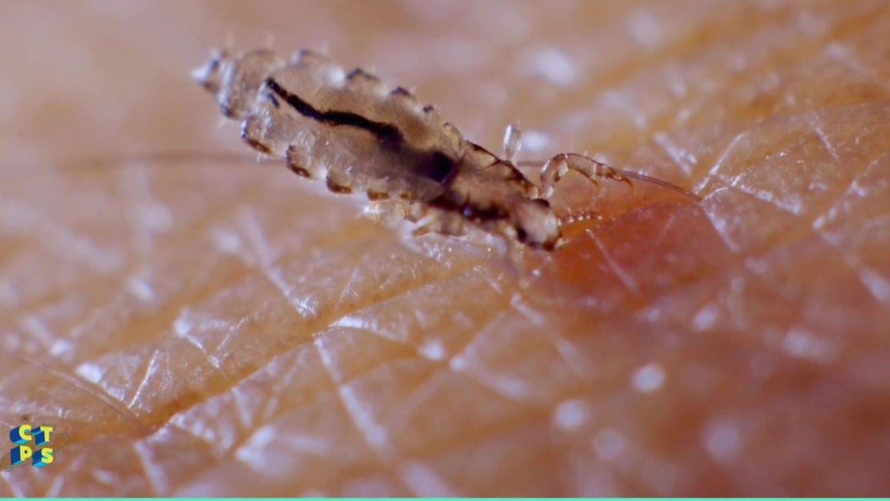 C'est toujours pas sorcier — La Guerre des poux