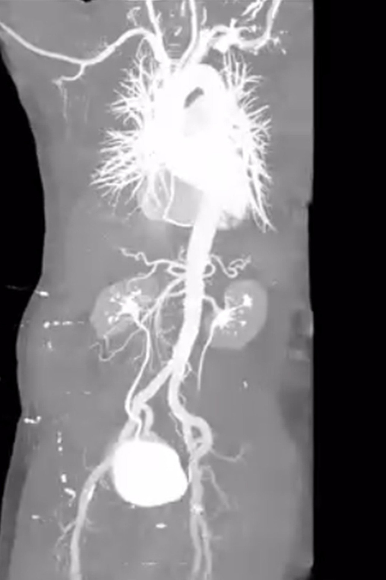 X-Ray Eros