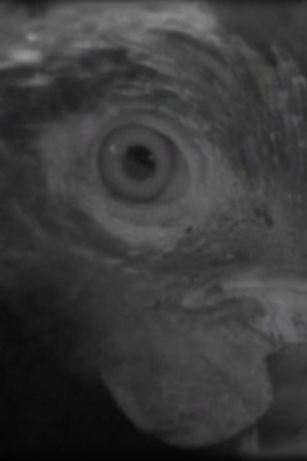 Ojo de pez