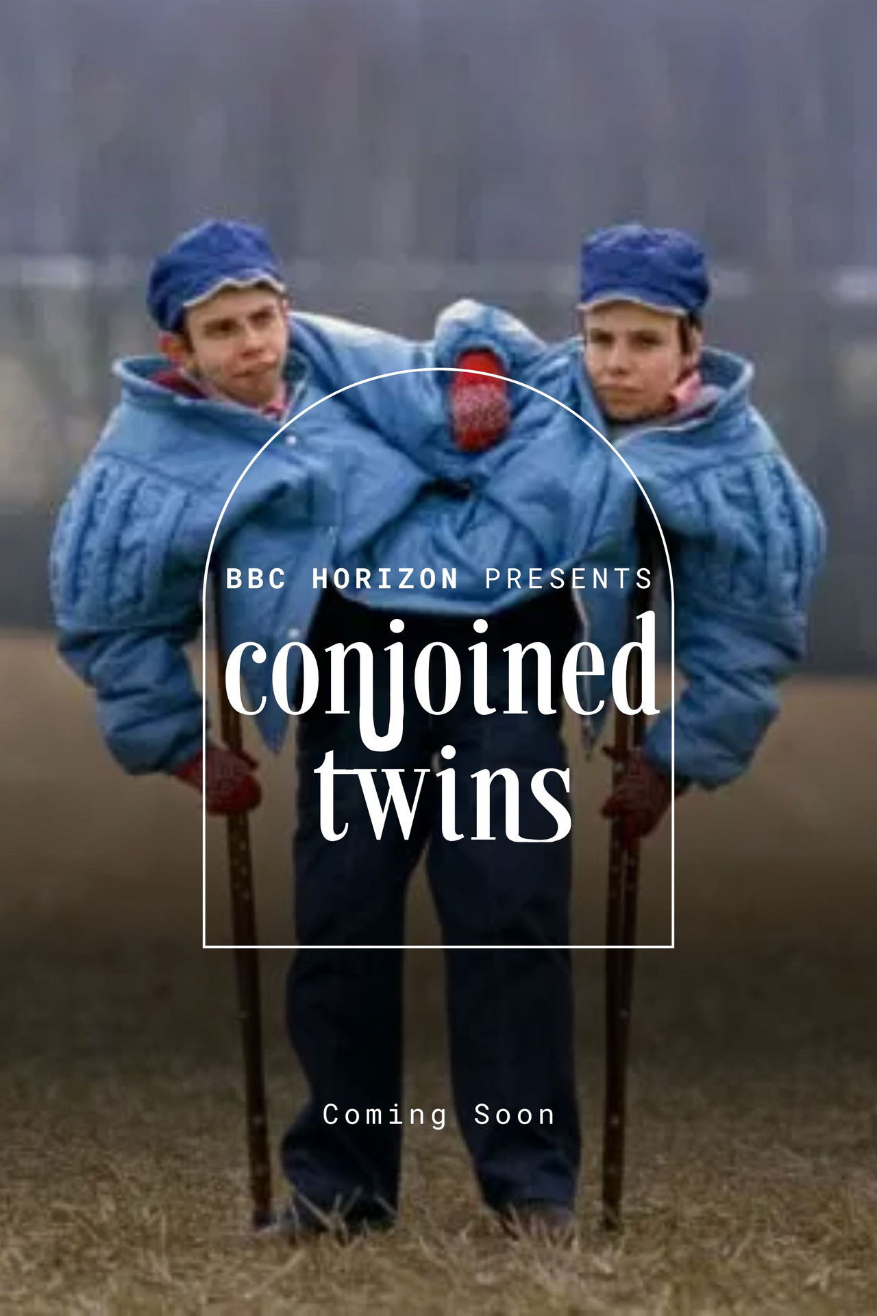 Horison: Conjoined Twins Backdrop