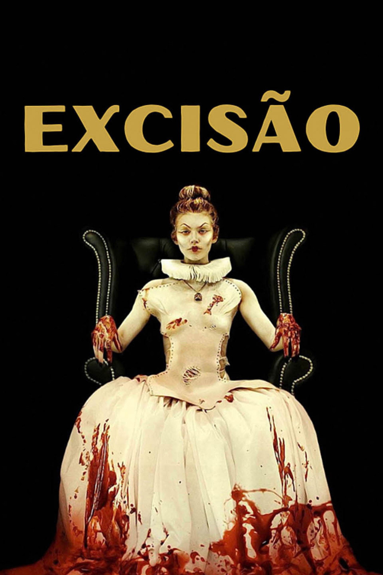 Excision