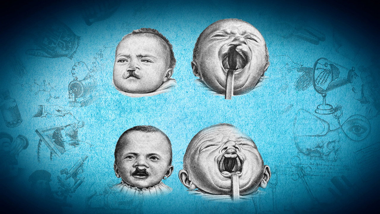 Plastic Surgery