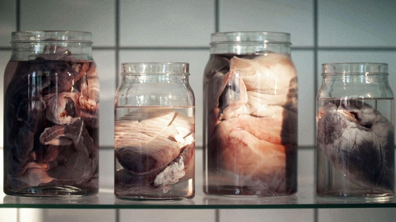 Hvad liget fortæller — Épisode 4