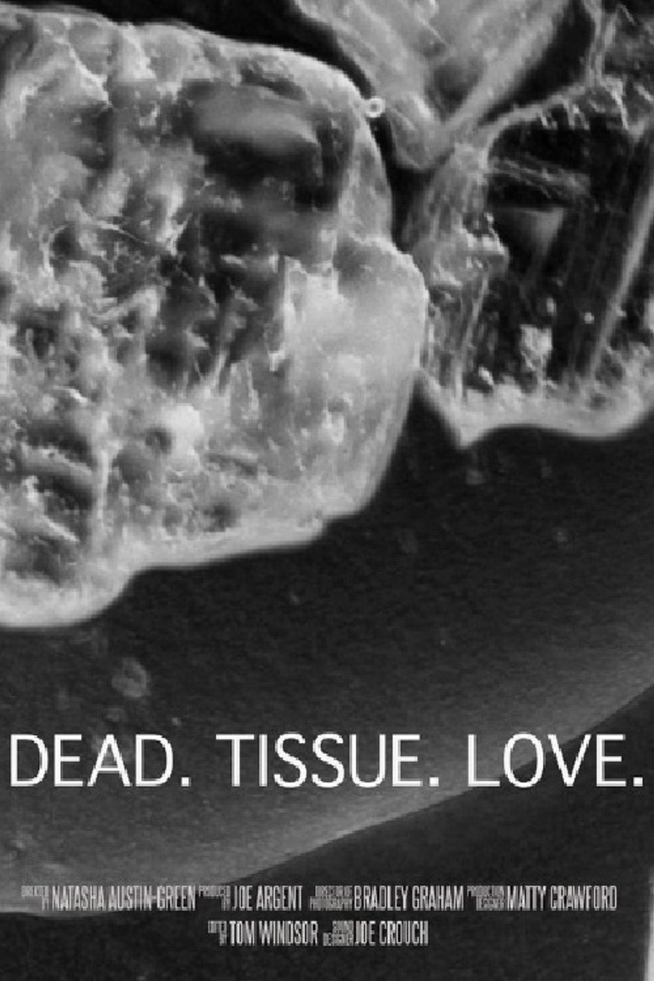 Dead. Tissue. Love.