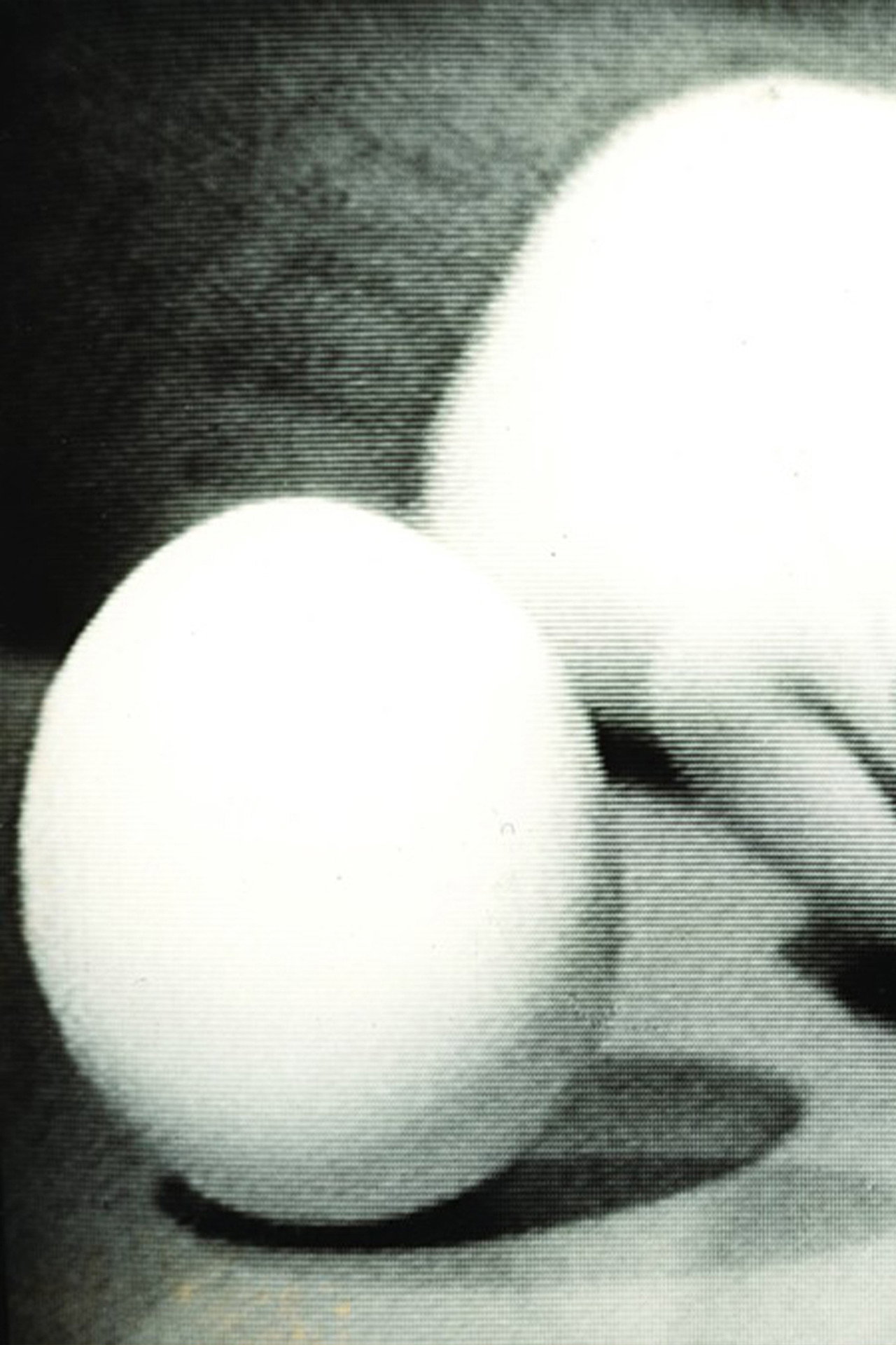 Statics of an Egg
