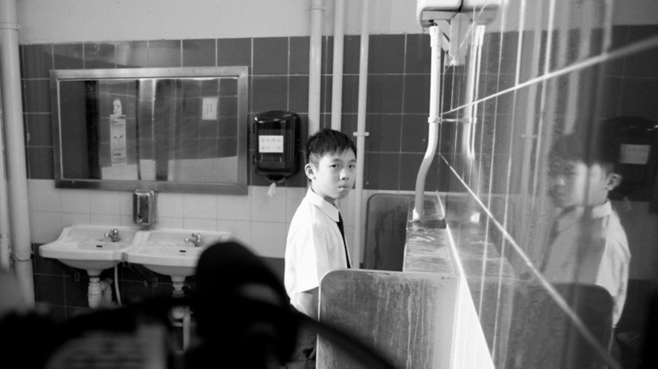 Epilepsy still 2