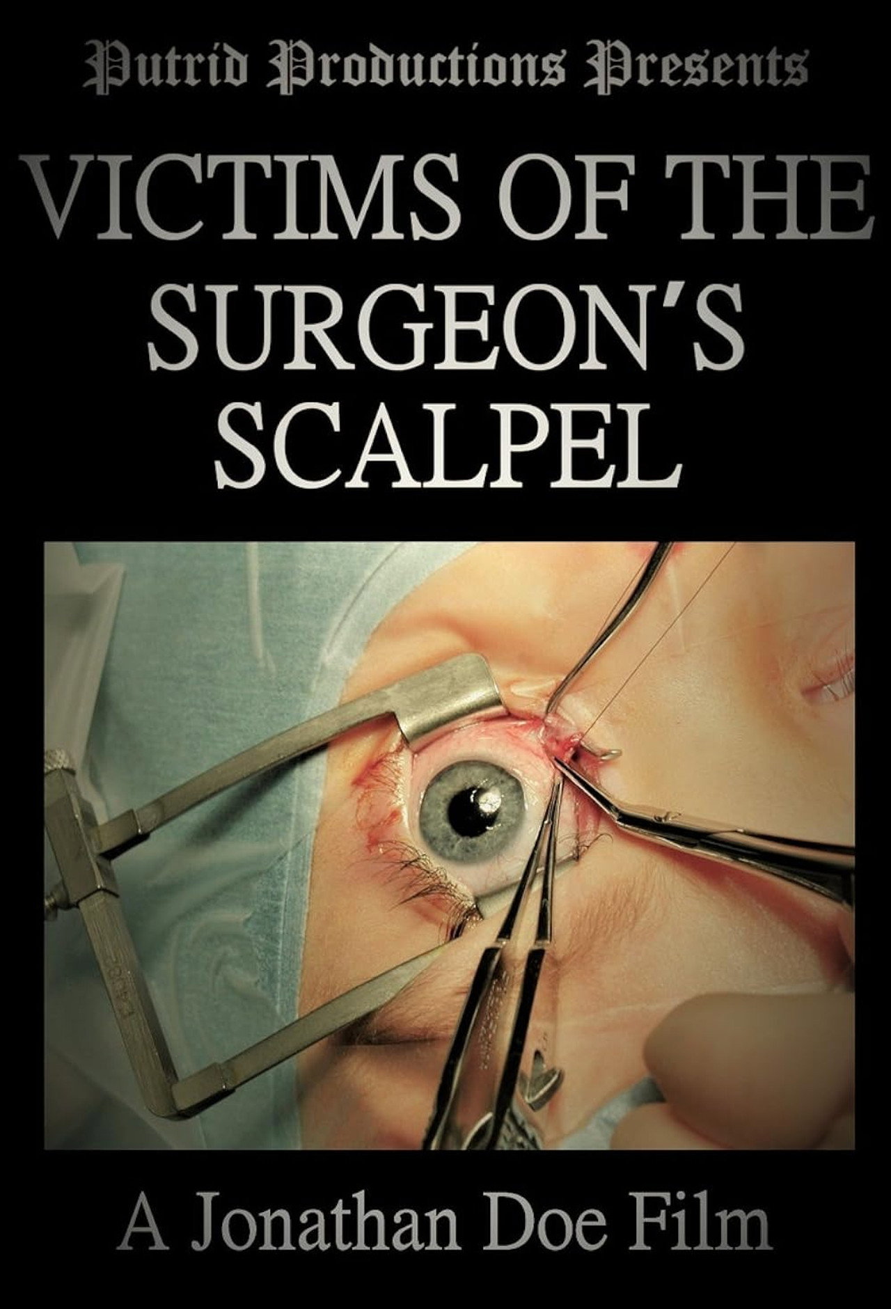 Victims of the Surgeon's Scalpel filmaffisch