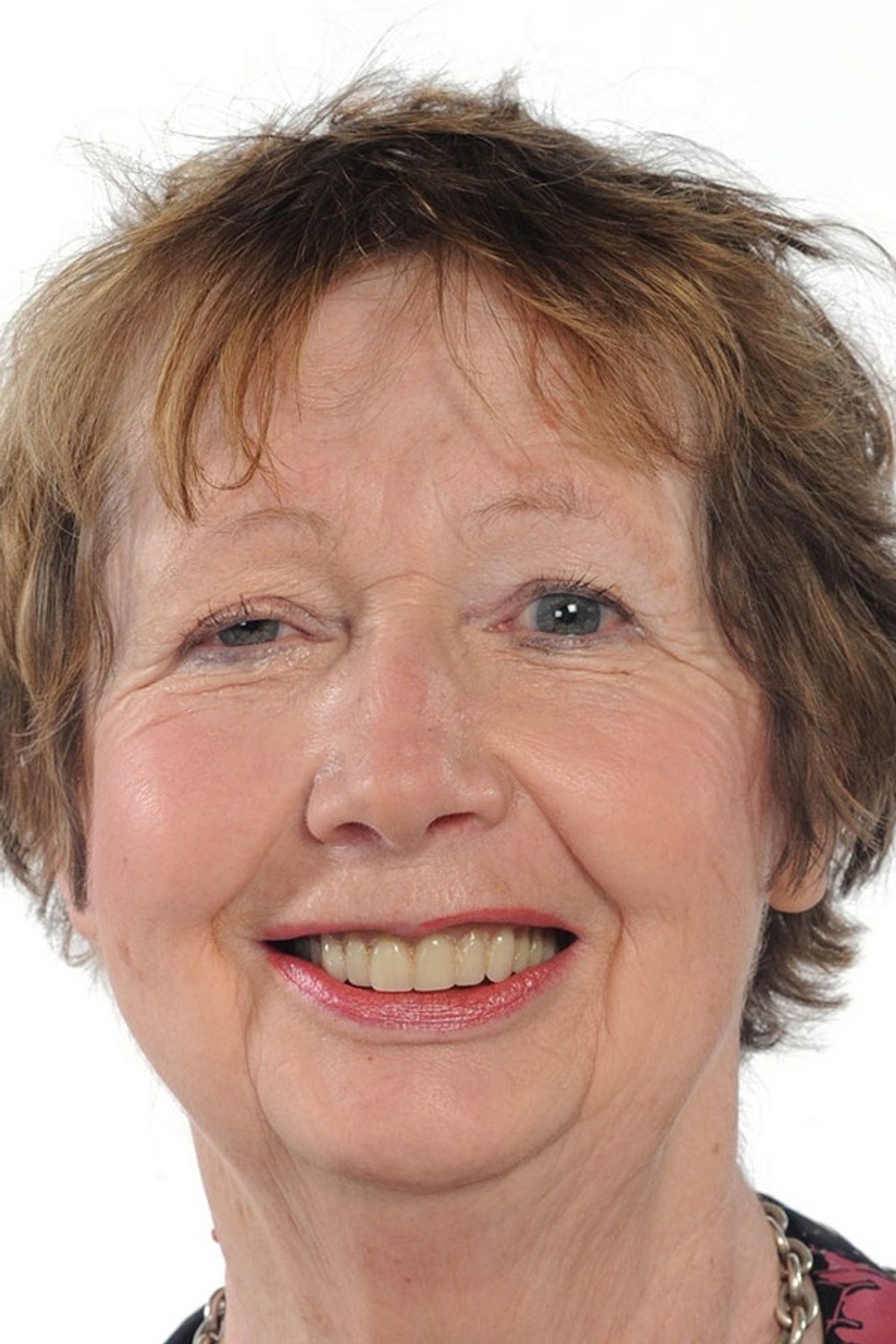 Joan Burnie