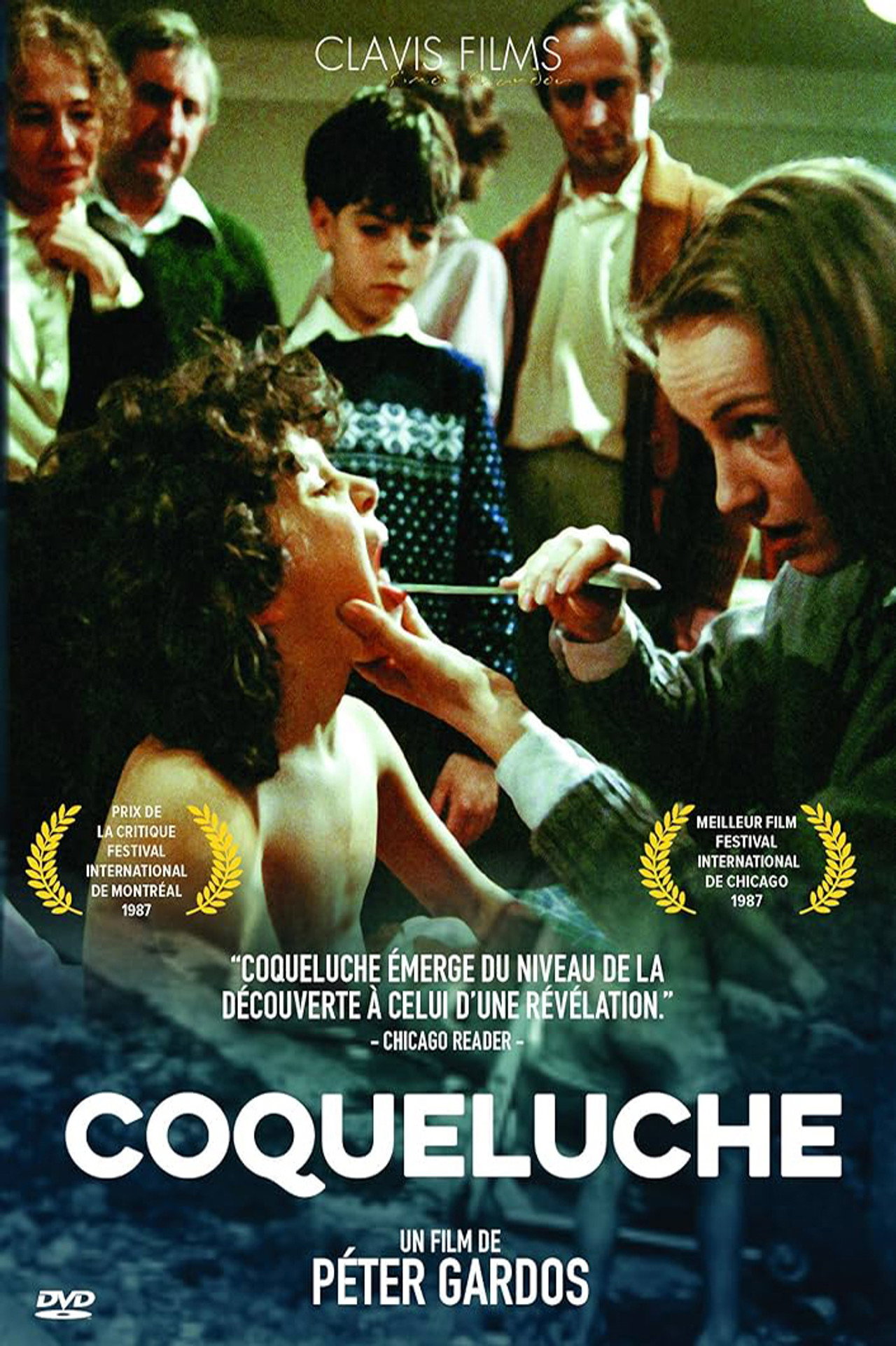 Coqueluche