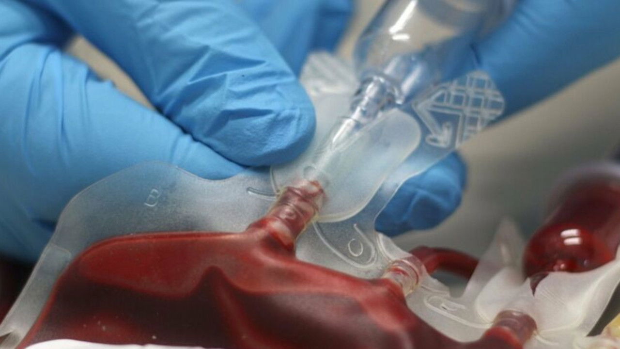 Les Mensonges de l'histoire — 1991 - L'affaire du sang contaminé