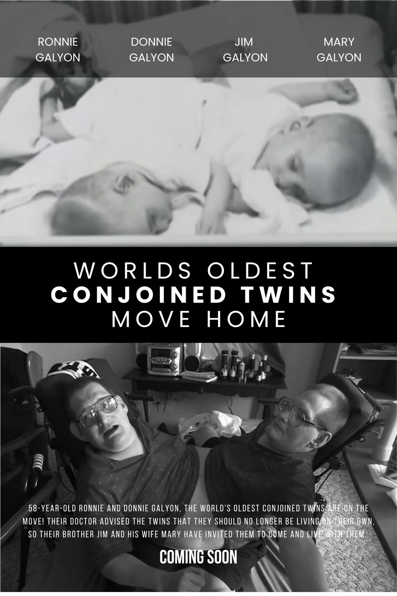 World's Oldest Conjoined Twins Move Home Backdrop
