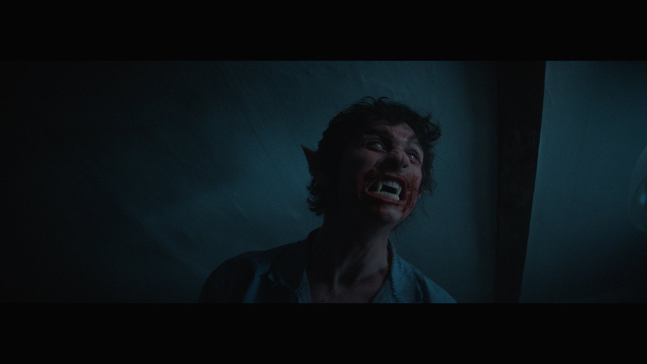 Needleteeth