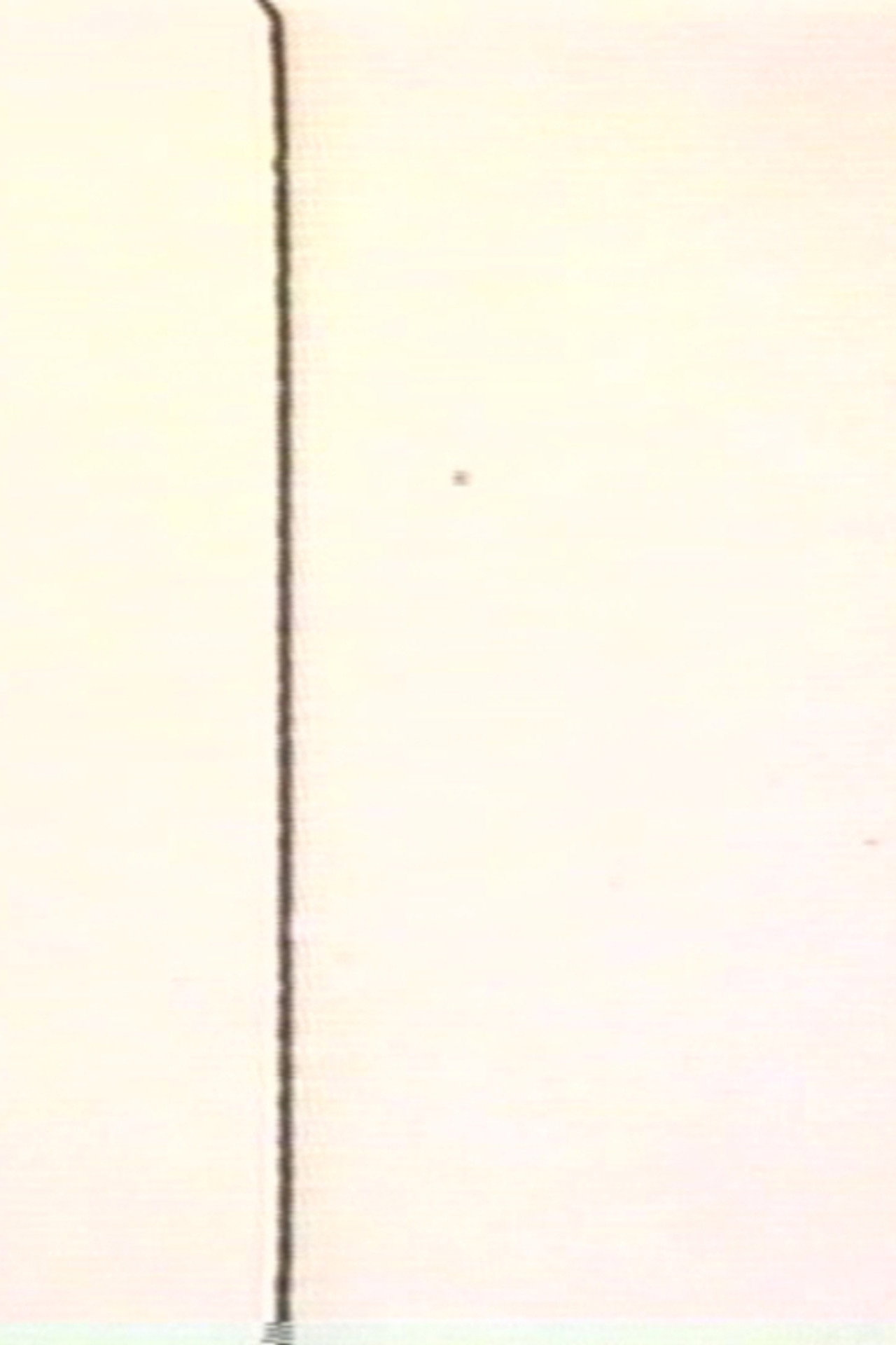 MA (Intervals)