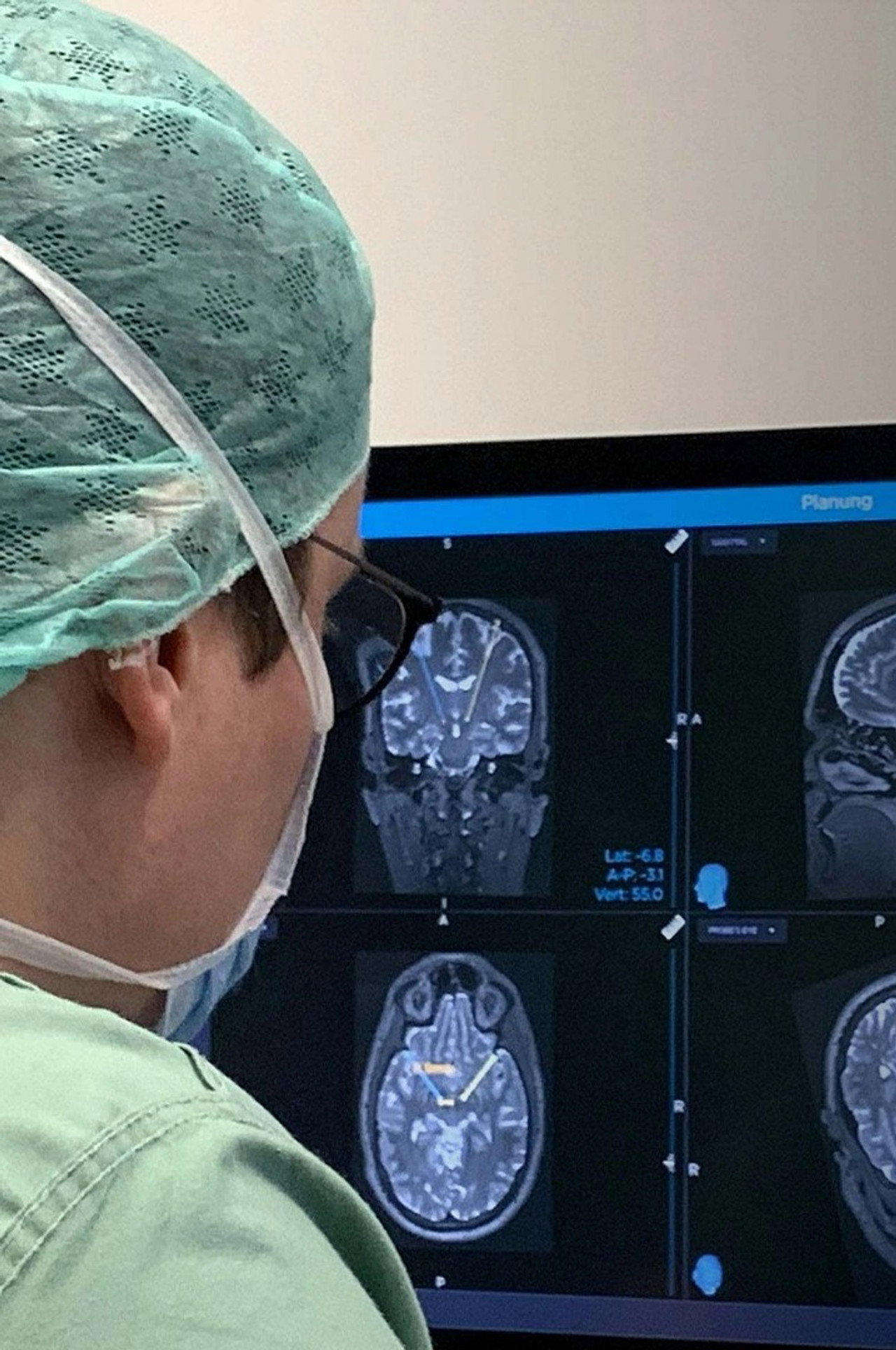 Gehirn unter Strom - Hilfe bei Depression, Epilepsie und Parkinson? filmaffisch