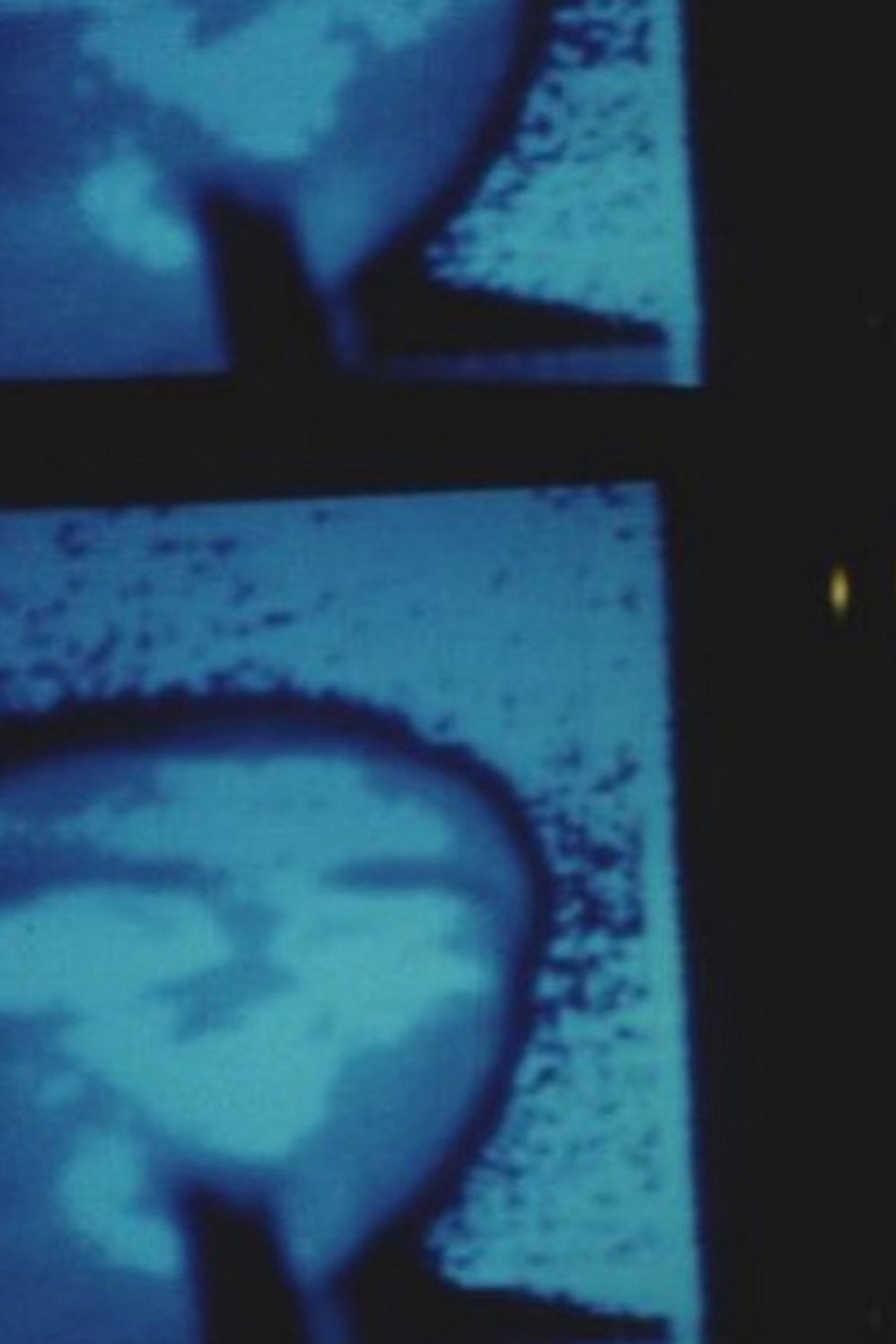 Thermoment filmaffisch
