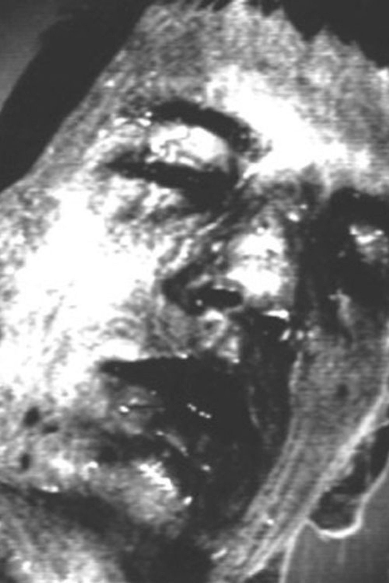 Got Away In the Dying Moments Backdrop