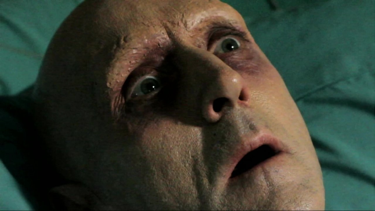 1000 Ways to Die - Season 3 Episode 11 : Cure for the Common Death Pt. II