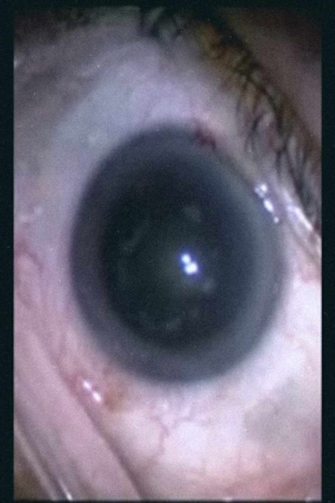 Botched Eyeball Operation filmaffisch