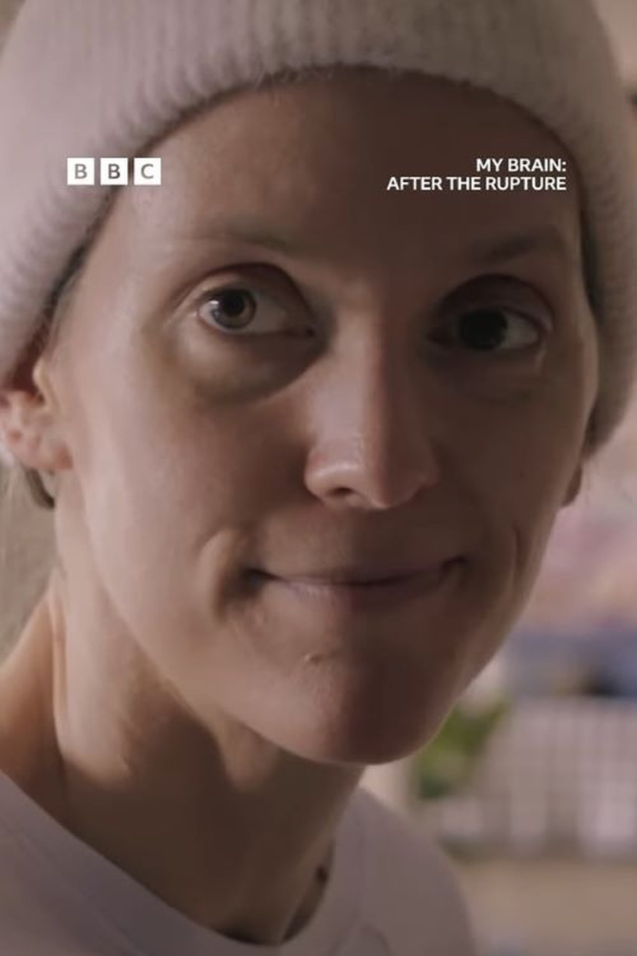 مشاهدة فيلم My Brain: After the Rupture مترجم بدون اعلانات - بوستر