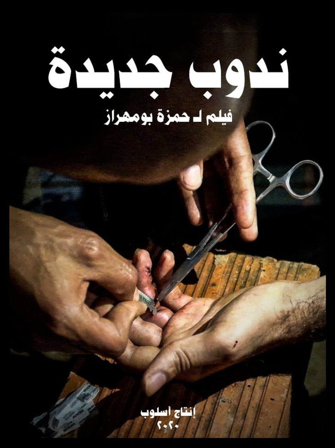 ندوب جديدة