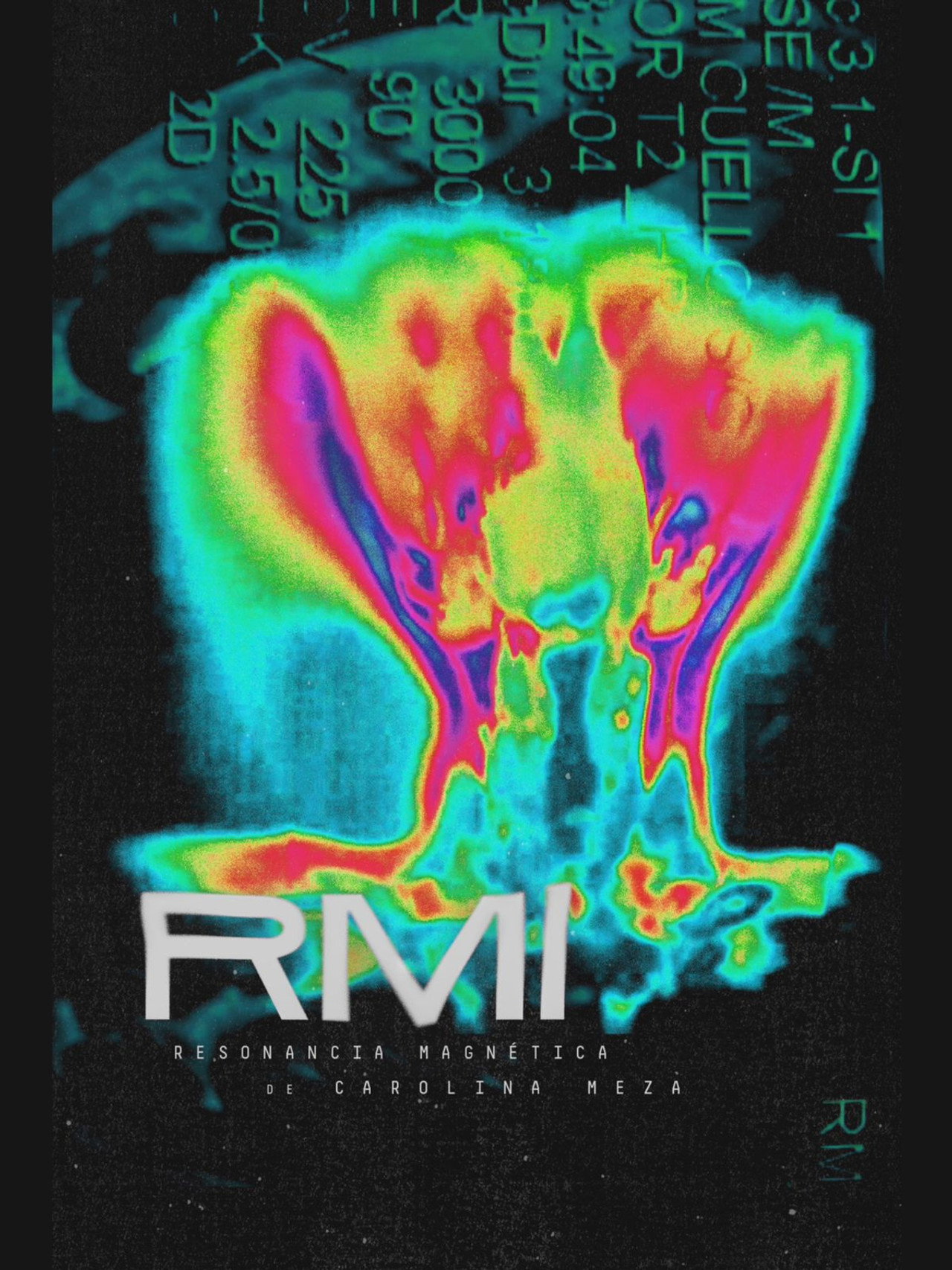 RMI o Resonancia Magnética filmaffisch