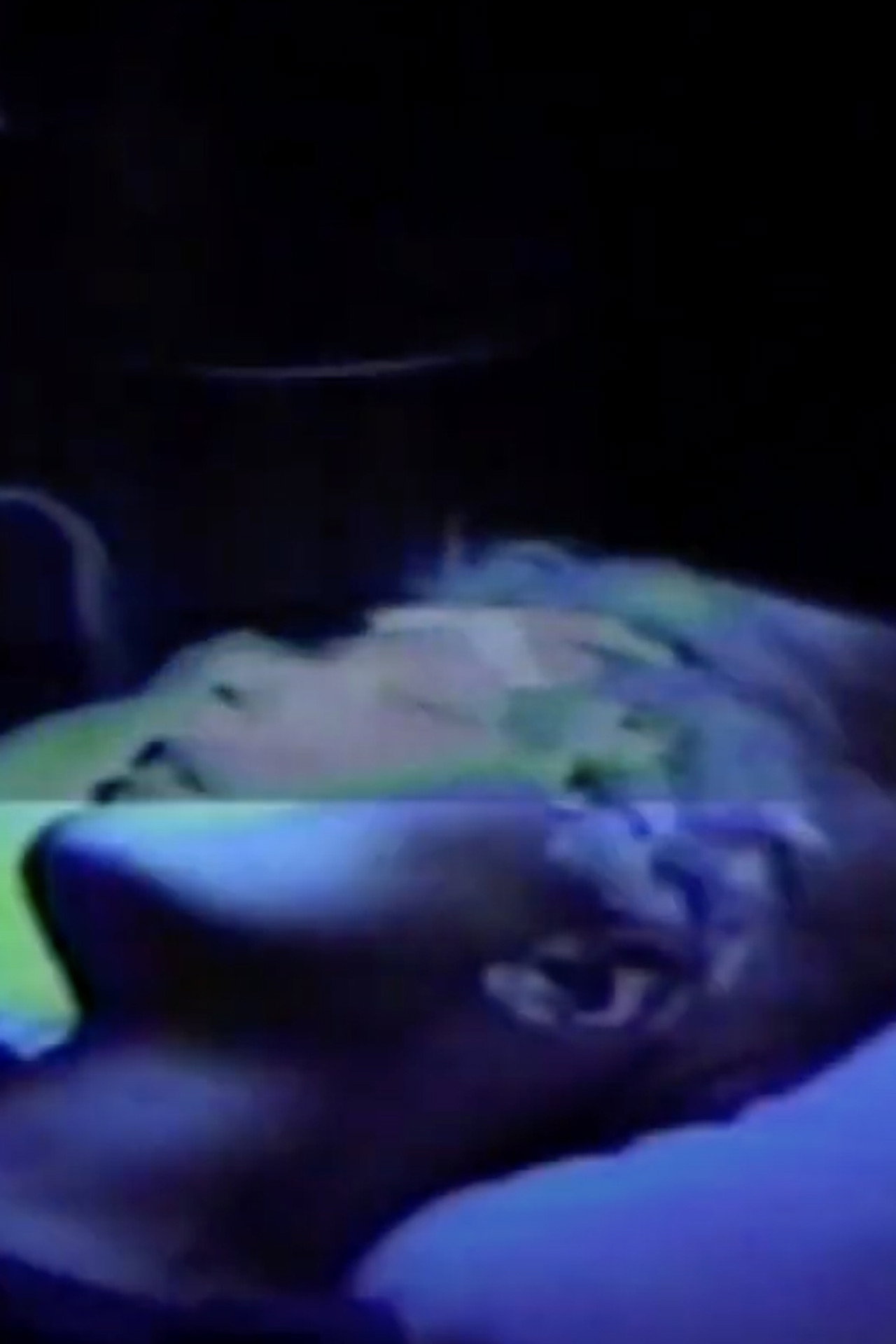 Seizure