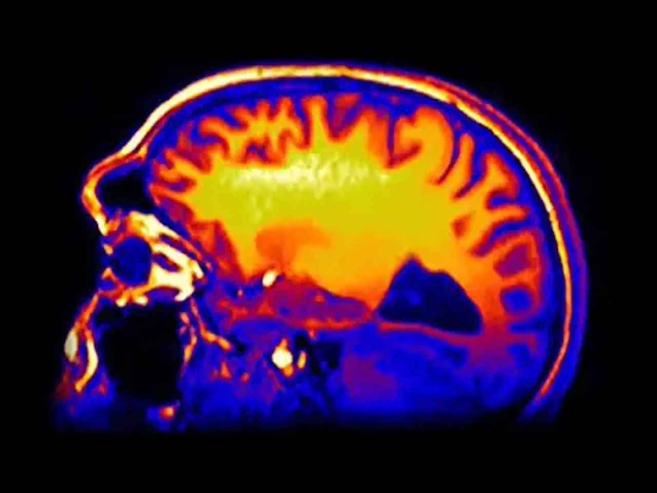 Bullied: You're Not Alone — Épisode 2