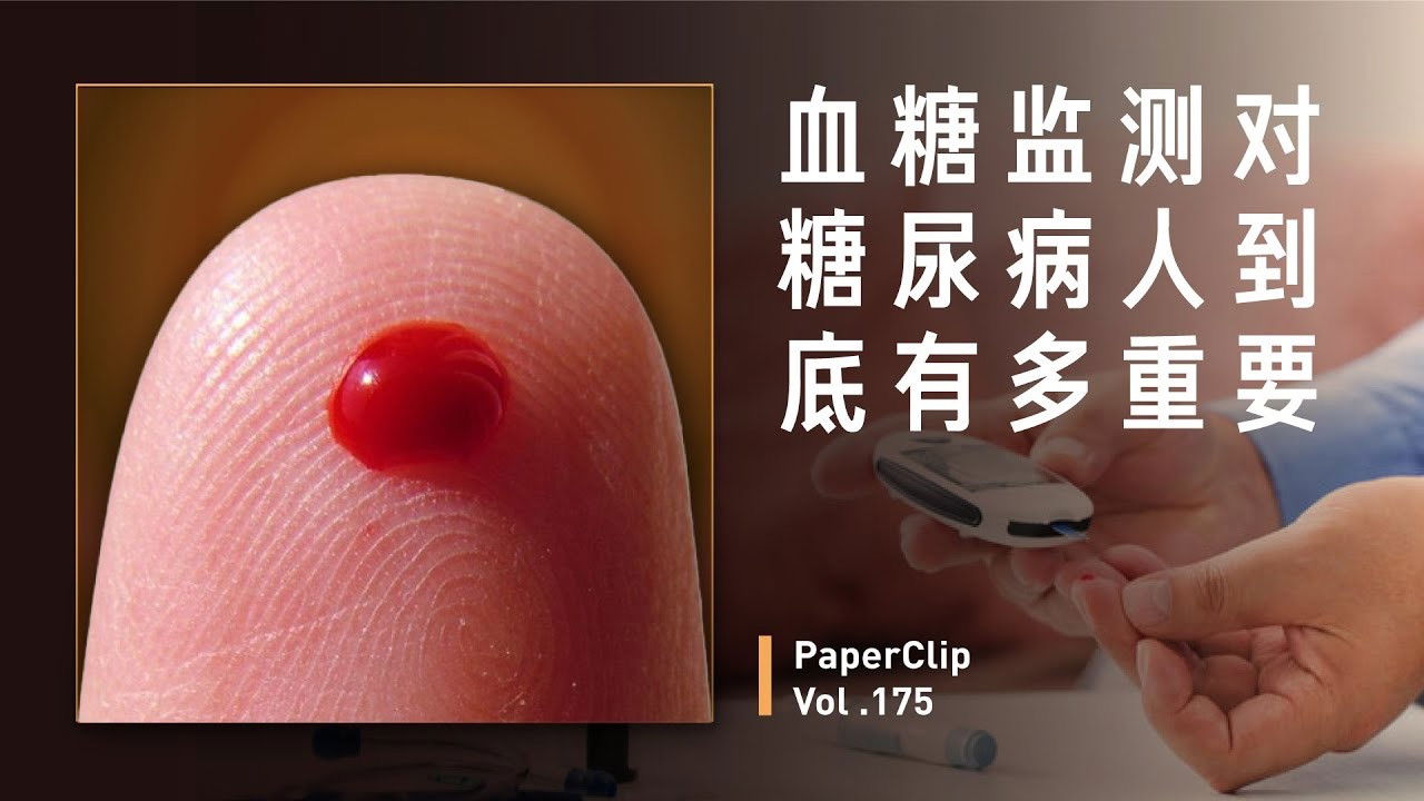 回形针PaperClip — Épisode 175