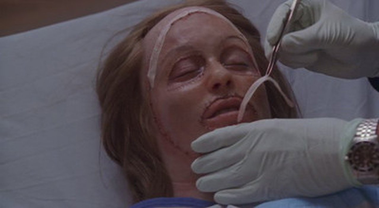 Nip/Tuck - Season 3 Episode 9 : Hannah Tedesco