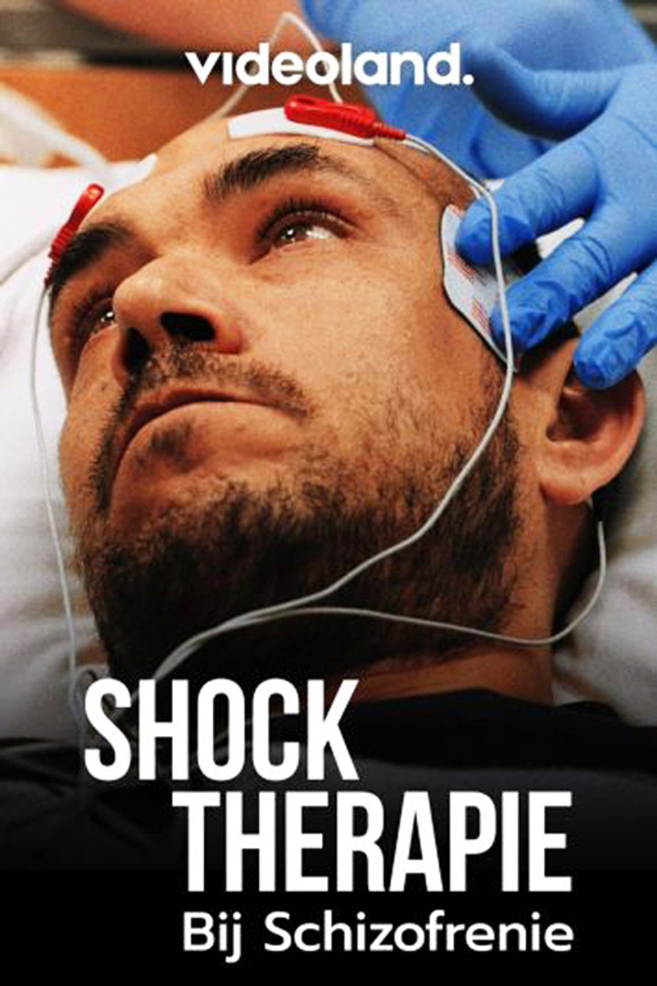 Shocktherapie bij Schizofrenie filmaffisch