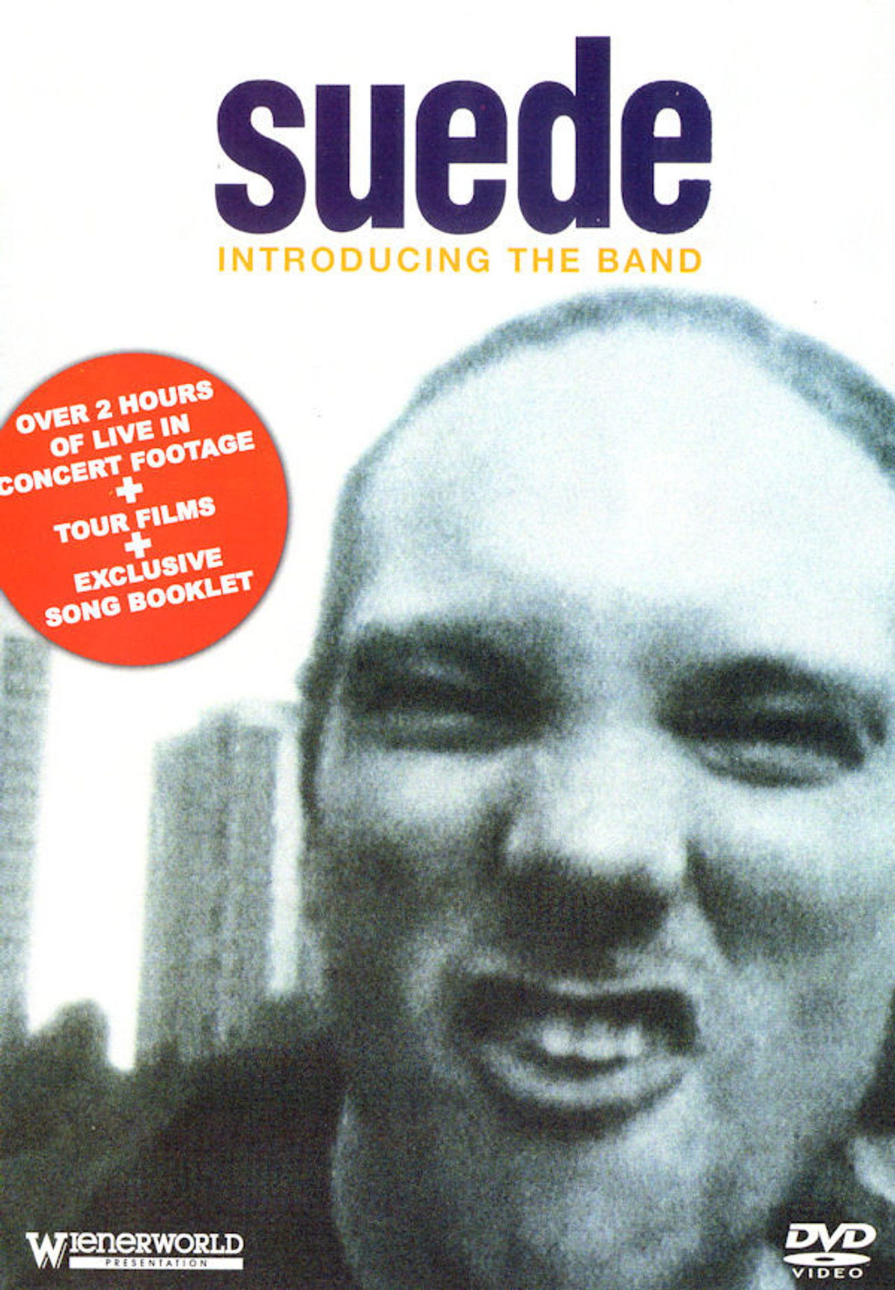 Suede - Introducing The Band Backdrop