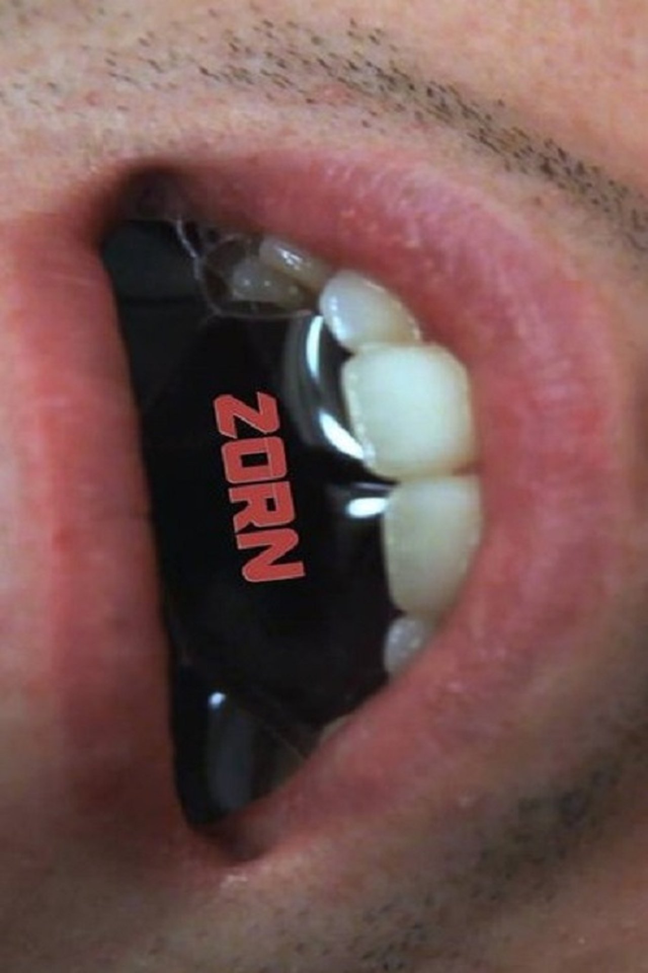 Zorn Zorn