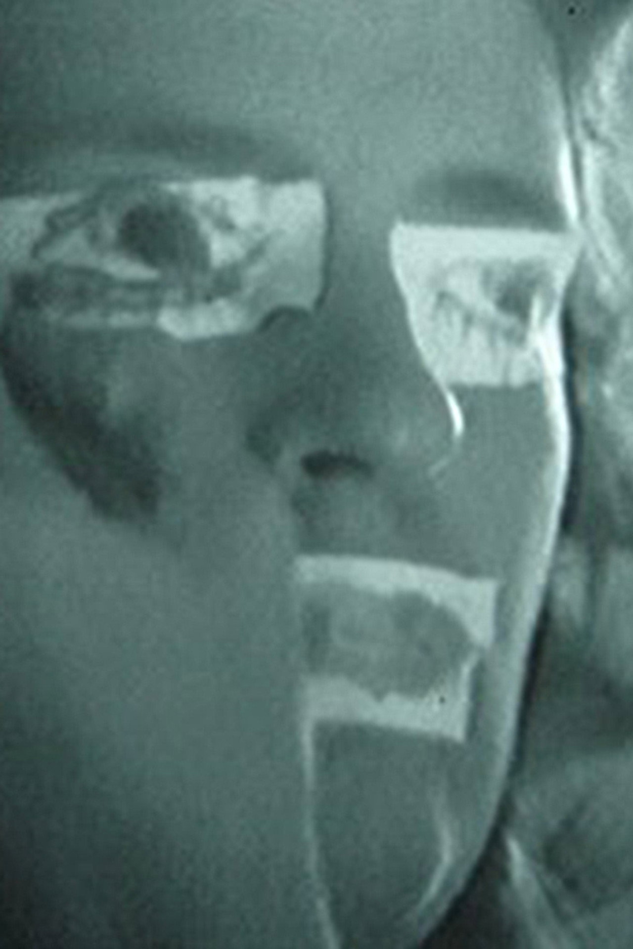 Preparação I Backdrop