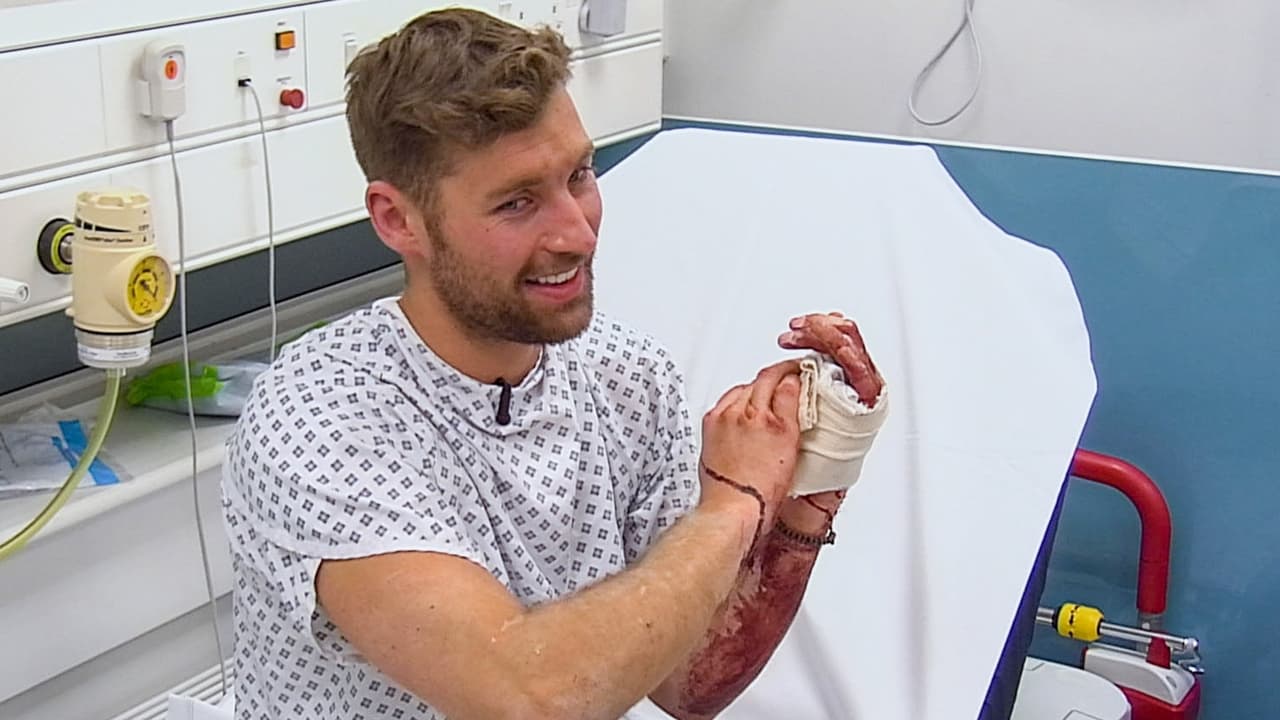 24 Hours in A&E - Season 22 Episode 4 : Skin Deep