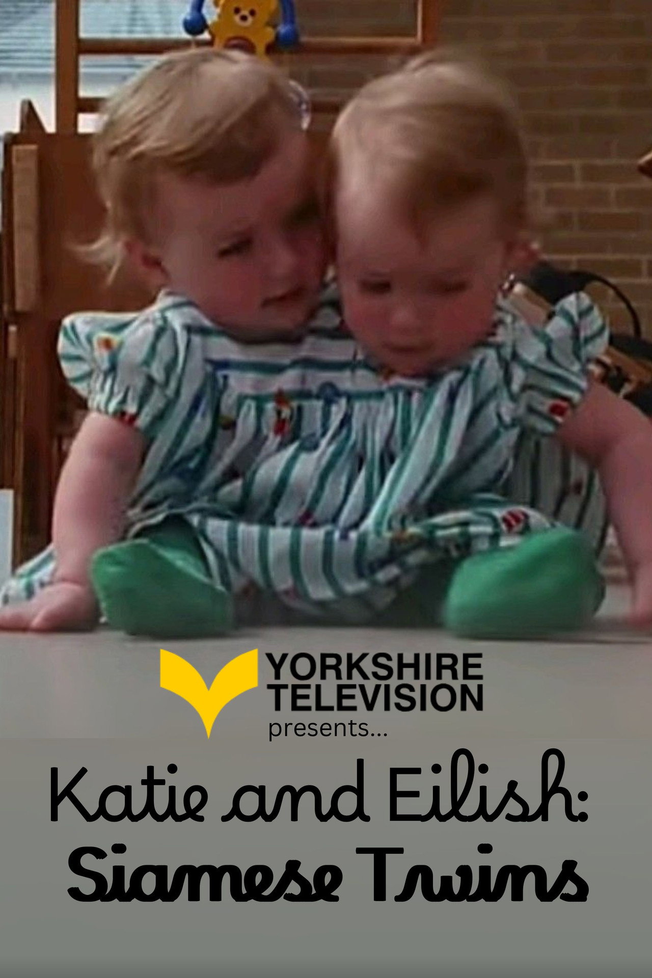 Katie and Eilish: Siamese Twins Backdrop